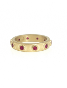Ruby Artemis Band Main View